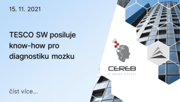 TESCO SW posiluje know-how pro diagnostiku mozku