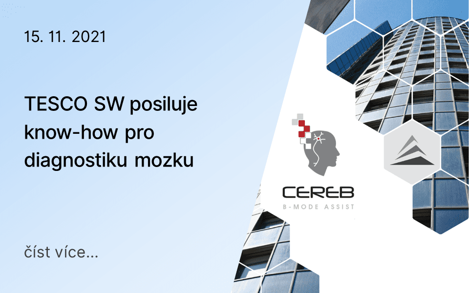 TESCO SW posiluje know-how pro diagnostiku mozku